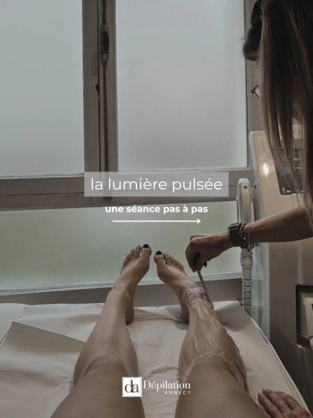 Épilation définitive à Annecy : quel est le prix moyen d’une séance en centre spécialisé ?