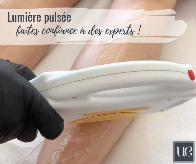 Pourquoi faut-il plusieurs séances de lumière pulsée pour ne plus avoir de poils sur Sévrier ?