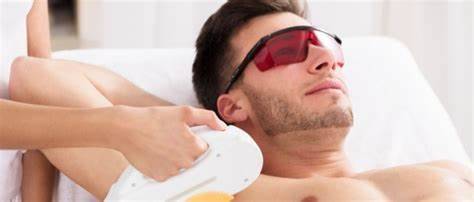 Contour de barbe impeccable : Optez pour l'épilation définitive à la lumière pulsée à Annecy