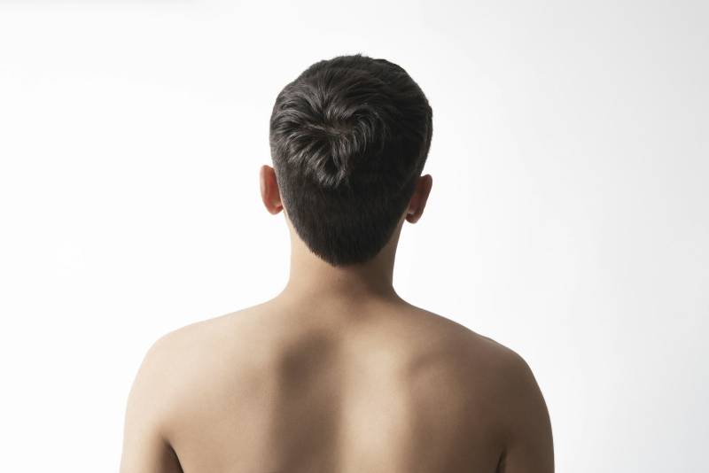 Épilation définitive du dos pour les hommes : Confort, esthétique et liberté